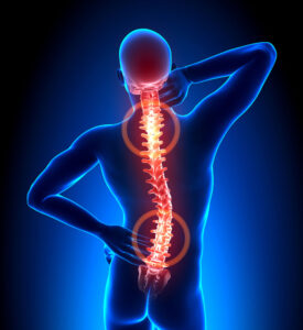 Spine image showing kyphoplasty