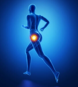 hip pain graphic