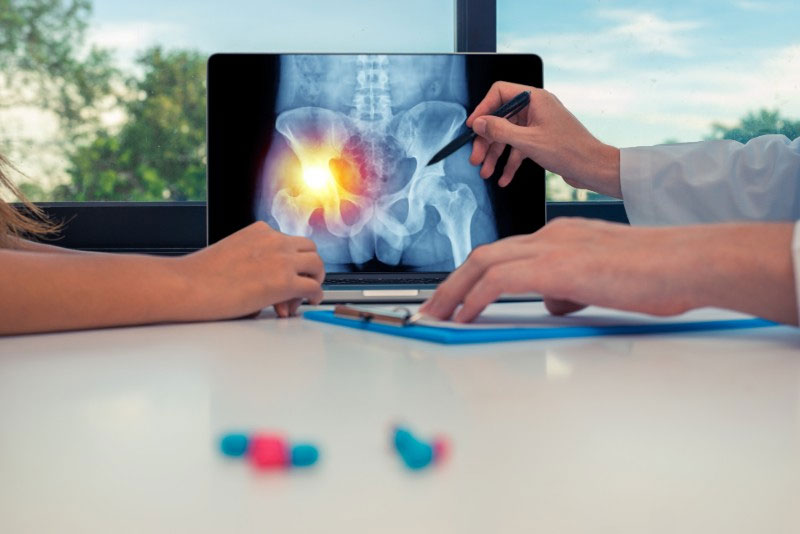hip pain xray