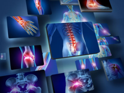 What is Orthopedic Sports Medicine?